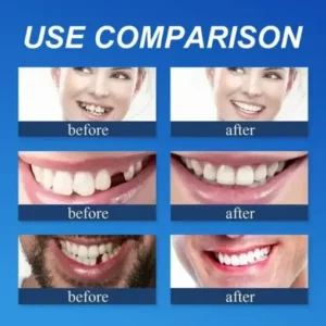 CLINCLII™ –Advanced Customized Full Denture Set