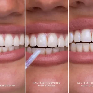 Clinclii™ Instant Glow Tooth Gloss–Your Smile’s Finishing Touch ✨