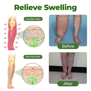 Clinclii® Professional Leg Circulation Cream