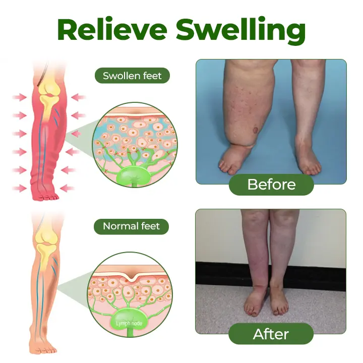 Clinclii® Professional Leg Circulation Cream