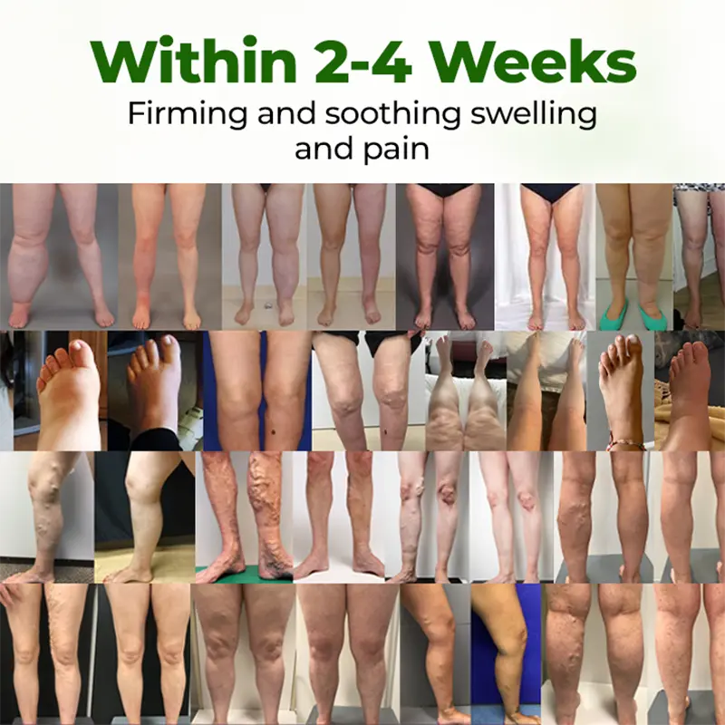 Clinclii® Professional Leg Circulation Cream