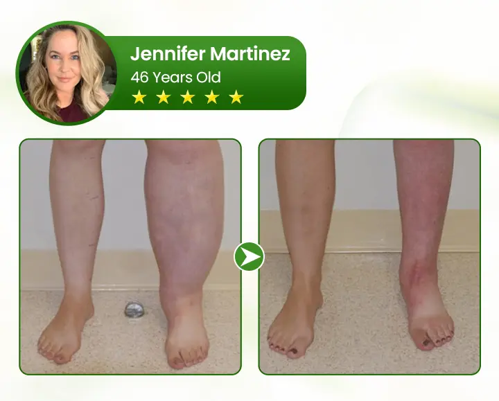 Clinclii® Professional Leg Circulation Cream