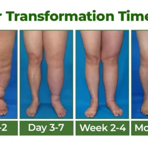 Clinclii® Professional Leg Circulation Cream