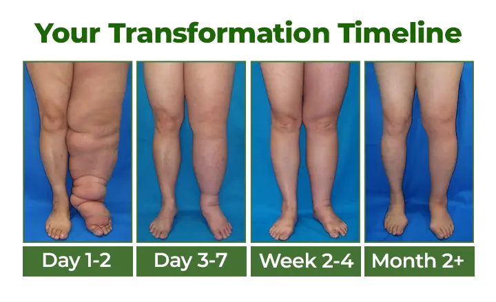 Clinclii® Professional Leg Circulation Cream