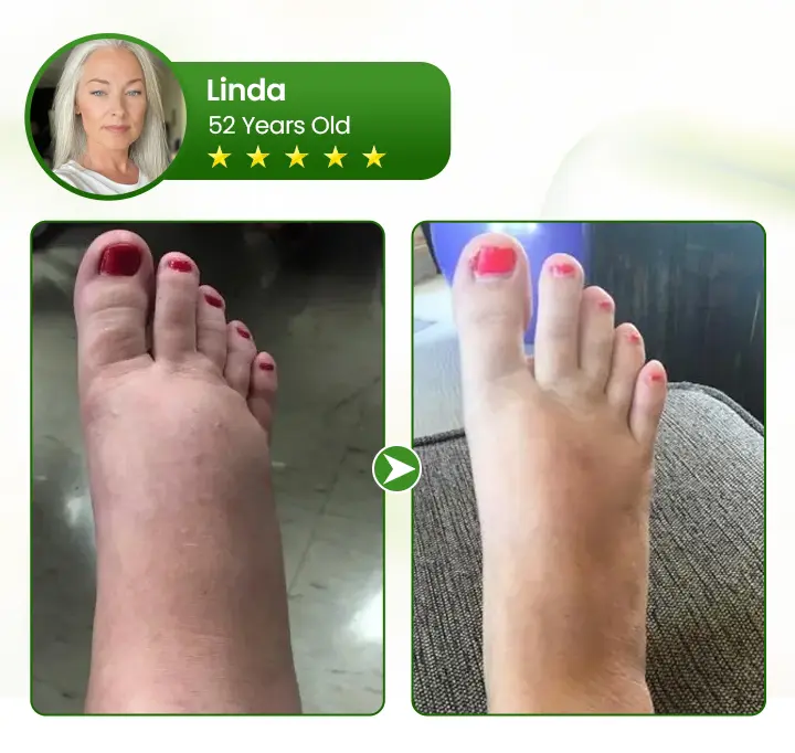 Clinclii® Professional Leg Circulation Cream