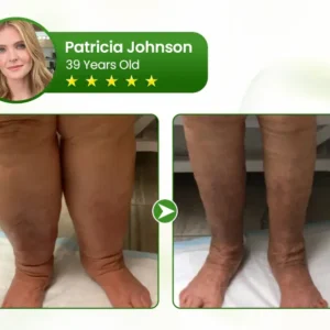 Clinclii® Professional Leg Circulation Cream