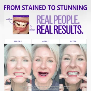 🦷Clinclii™ V36 Whitening Strips – Professional Teeth Whitening at Home(UPGRADED VERSION)