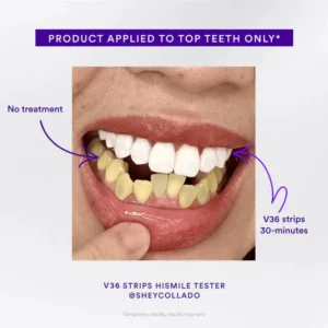 Final 3 Hours: 60%OFF🔥Clinclii™Whitening Strips – Professional Teeth Whitening at Home