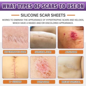 𝐎𝐟𝐟𝐢𝐜𝐢𝐚𝐥 𝐁𝐫𝐚𝐧𝐝 𝐒𝐭𝐨𝐫𝐞 | Clinclii® 3-in-1 Microneedle Anti-Aging Patch