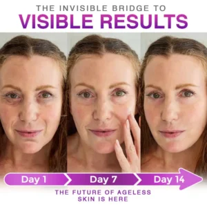 𝐎𝐟𝐟𝐢𝐜𝐢𝐚𝐥 𝐁𝐫𝐚𝐧𝐝 𝐒𝐭𝐨𝐫𝐞 | Clinclii® 3-in-1 Microneedle Anti-Aging Patch