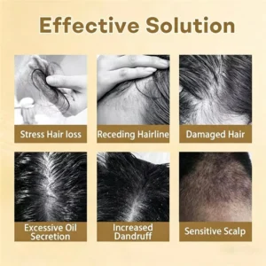 Best Seller๐ฅ Clinclii Hair Regrowth Capsules, Newly Upgraded,Nano Penetration, Deep into Hair Roots๐๐๐๐ข๐๐ฉ๐๐-๐๐๐ข๐ ๐๐๐๐๐ง