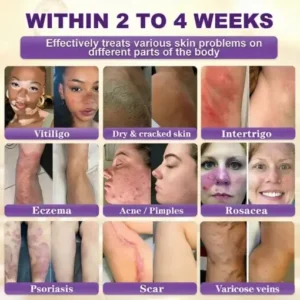 Clinclii® Biotin 10-in-1 Skin Restoration Cream