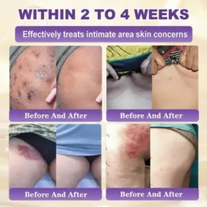 Clinclii® Biotin 10-in-1 Skin Restoration Cream