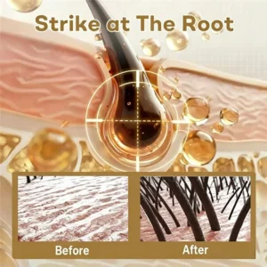 🔥Clinclii Hair Regrowth Capsules - Nano Penetration, Deep into Hair Roots🎉𝙇𝙞𝙢𝙞𝙩𝙚𝙙-𝙏𝙞𝙢𝙚 𝙊𝙛𝙛𝙚𝙧