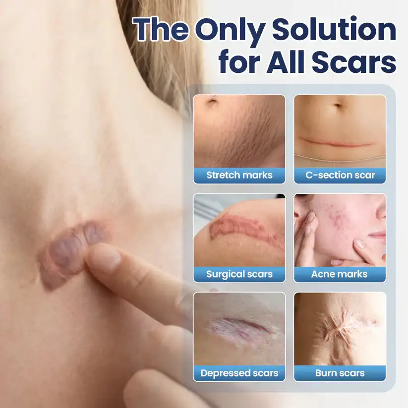 Free at 48% OFF!🔥🔥|CLINCLII® Texture Repair Gel