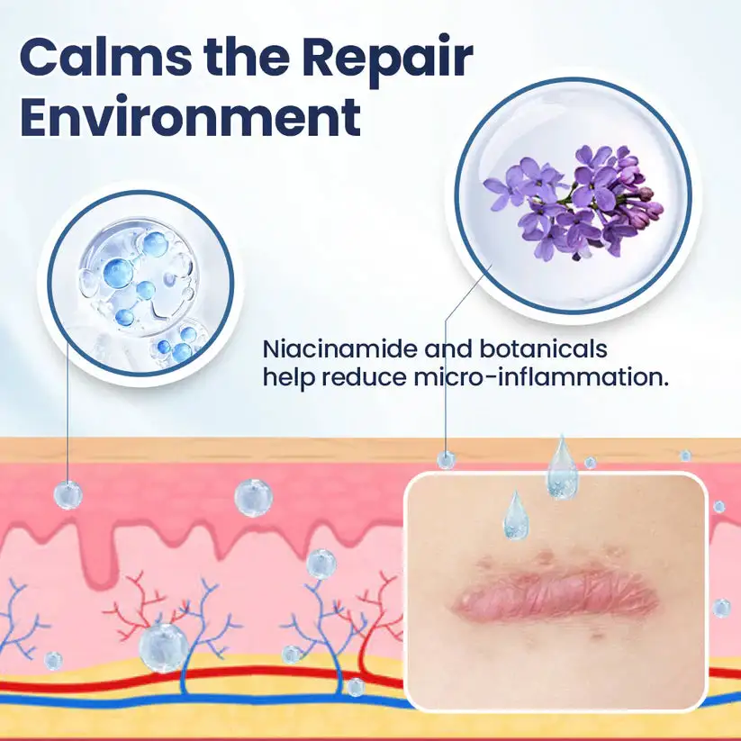 Free at 48% OFF!🔥🔥|CLINCLII® Texture Repair Gel