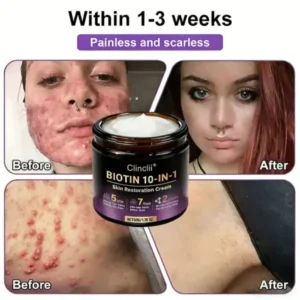 Made and Shipped from USA🍁Clinclii® Biotin 10-in-1 Skin Restoration Cream – Last Day Promotion: 75% OFF