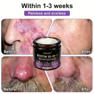 Made and Shipped from USA🍁Clinclii® Biotin 10-in-1 Skin Restoration Cream – Last Day Promotion: 75% OFF