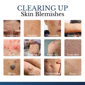 ✨Buy 1 Get 1 FREE Today Only – Clinclii® DermFixPro 2-in-1 Microneedle & Hydrocolloid Patch