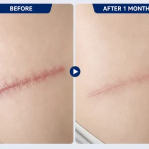 CLINCLII Advanced Silicone Scar & Wrinkle Smoothing Gel