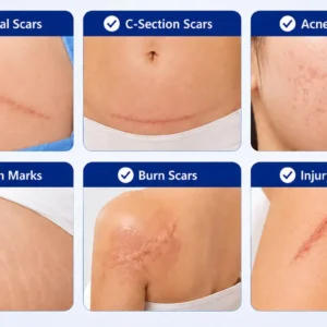 CLINCLII Advanced Silicone Scar & Wrinkle Smoothing Gel