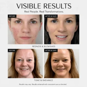 Clinclii® Rosacea Corrector